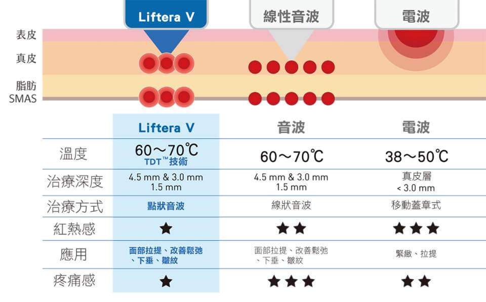 立特拉 渦漩音波第二代 非侵入式的音波拉提療程 哪些人適合使用