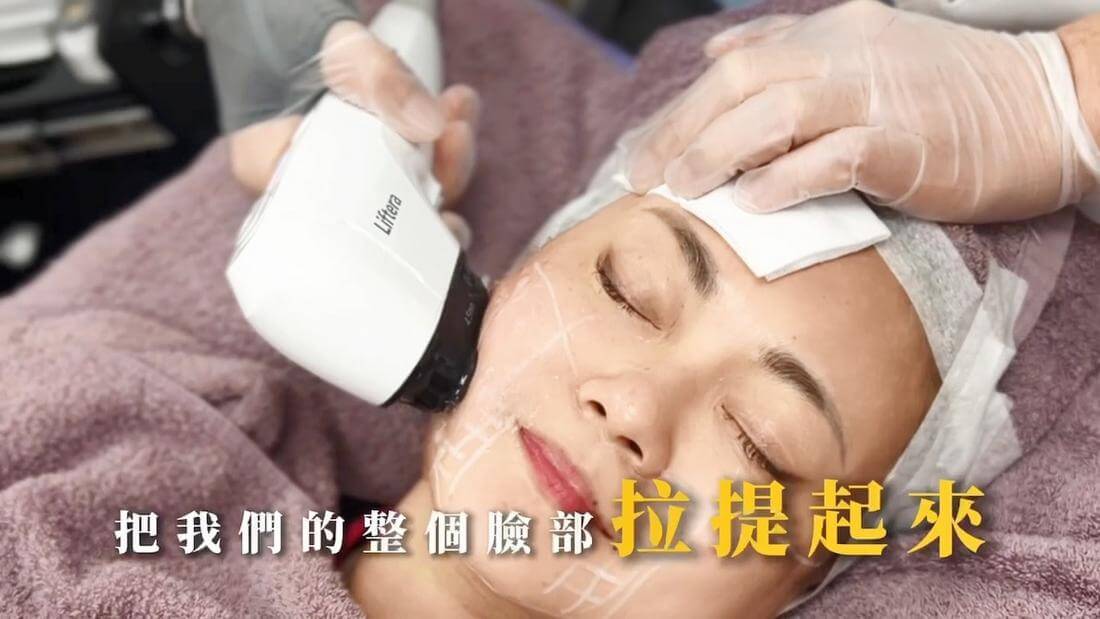 日料闆娘Ami的美麗秘密 立特拉音波、玻尿酸、肉毒打造親切笑容與完美輪廓