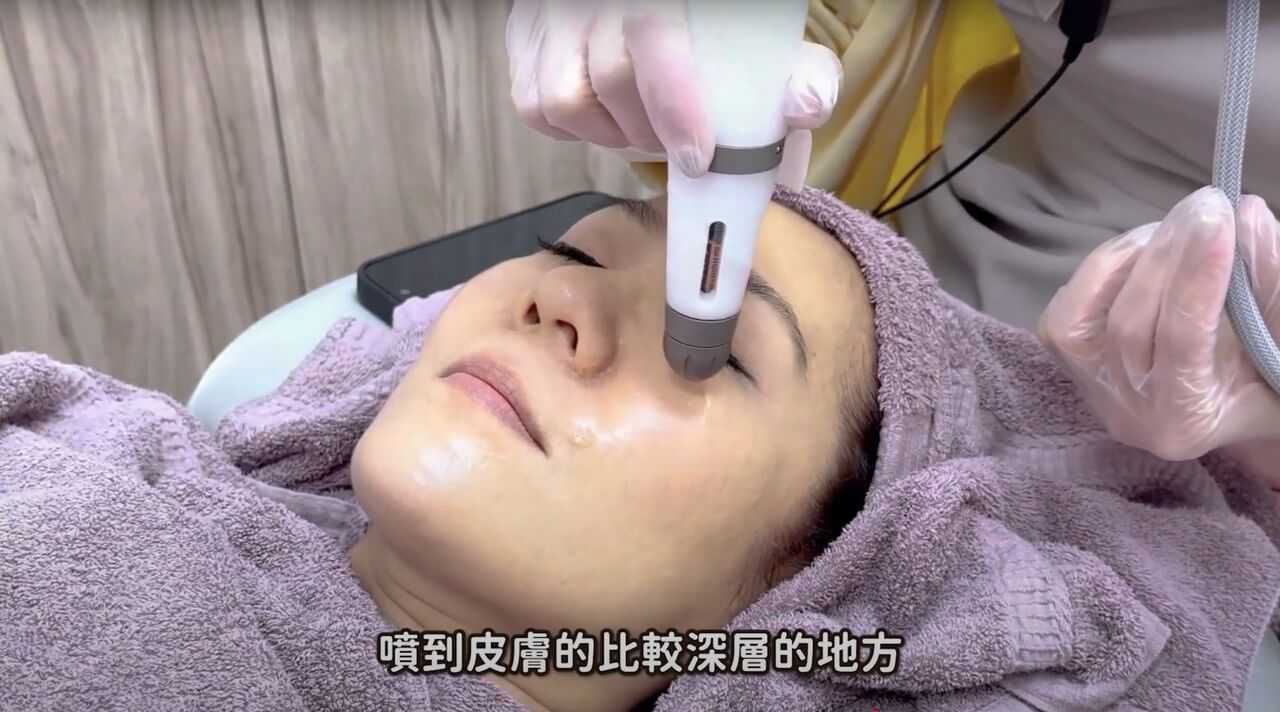 德國SEYO水光儀 告別春季肌膚困擾 深層保濕淨白提亮 姿佑姐的秘密武器